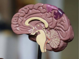 Organización Mundial de la Salud (OMS), deterioro cognitivo y demencia, enfermedad de Alzheimer , hipertensión arterial, la diabetes y la hipercolesterolemia