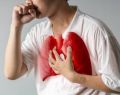 COVID-19 grave eleva el riesgo de desarrollar tuberculosis